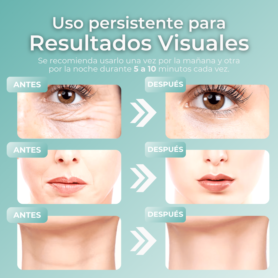 Elimina tus arrugas y obtén una piel suave con BeautySkin Pro™