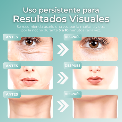 Elimina tus arrugas y obtén una piel suave con BeautySkin Pro™